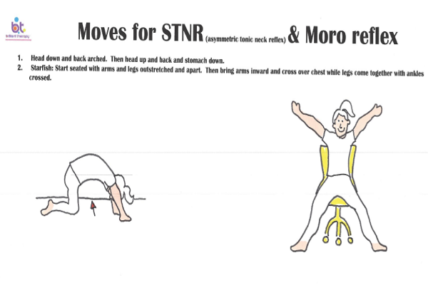 movesforSTNR&mororeflec